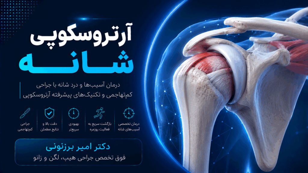 آرتروسکوپی شانه : وقتی هیچ جا از دید جراح پنهان نمیماند