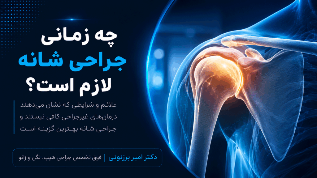 چه زمانی احتیاج به جراحی شانه داریم؟ خصوصیات متخصص جراح شانه