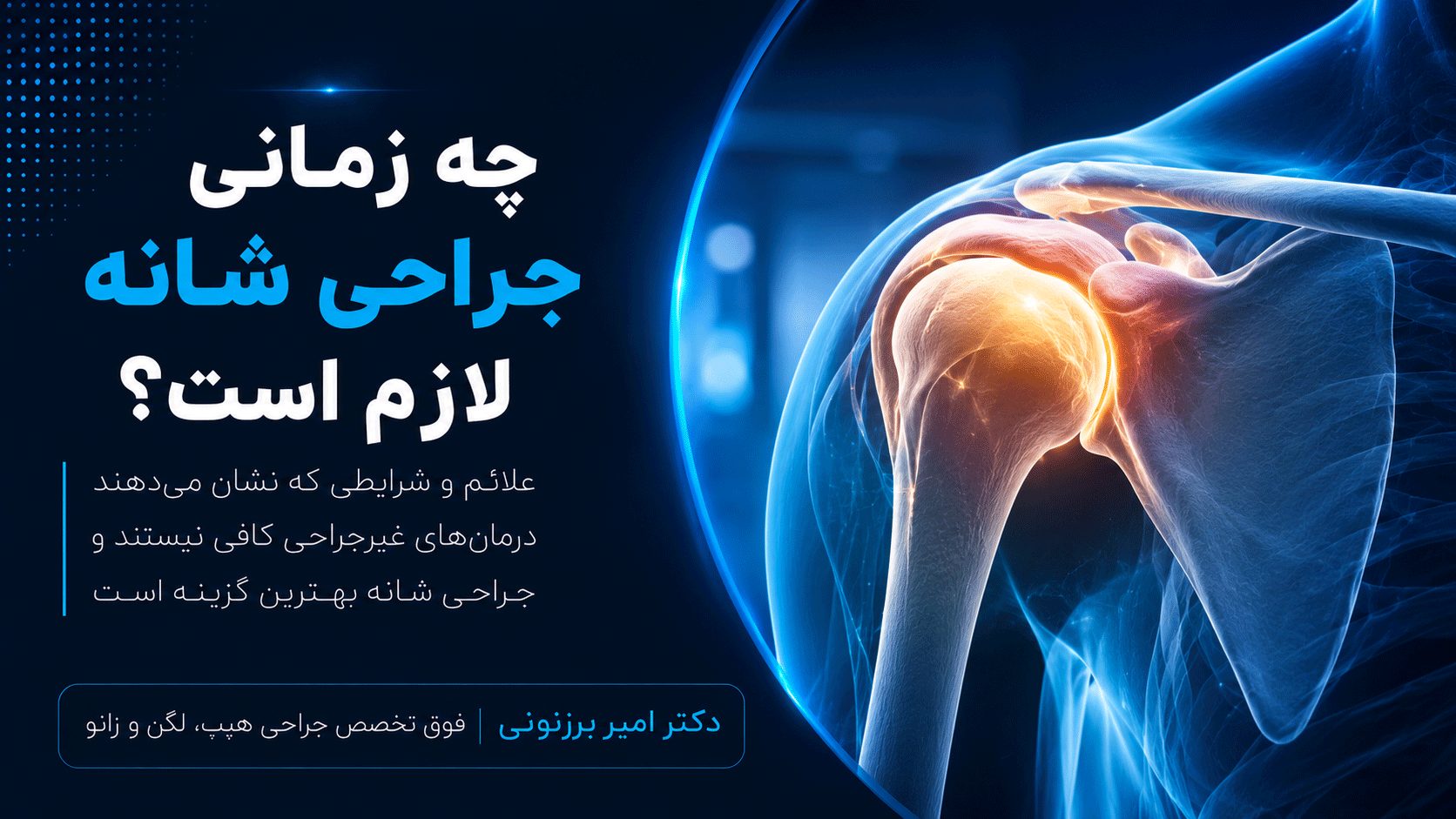 چه زمانی احتیاج به جراحی شانه داریم؟ خصوصیات متخصص جراح شانه