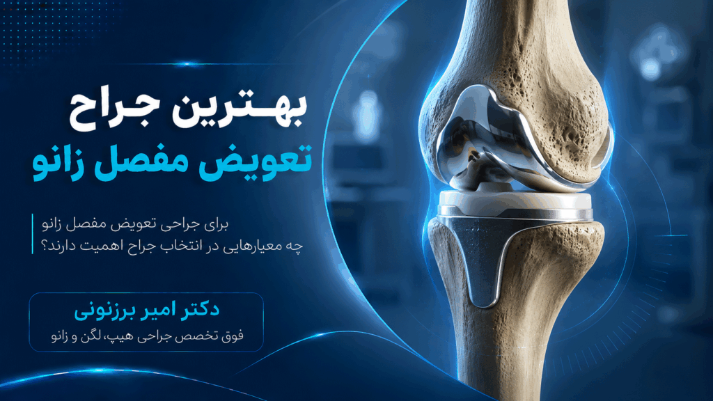 جراح زانو کیست؟ معرفی بهترین متخصص زانو