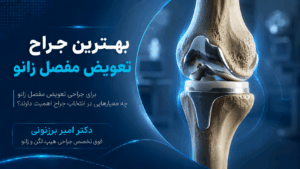 جراح زانو کیست؟ معرفی بهترین متخصص زانو