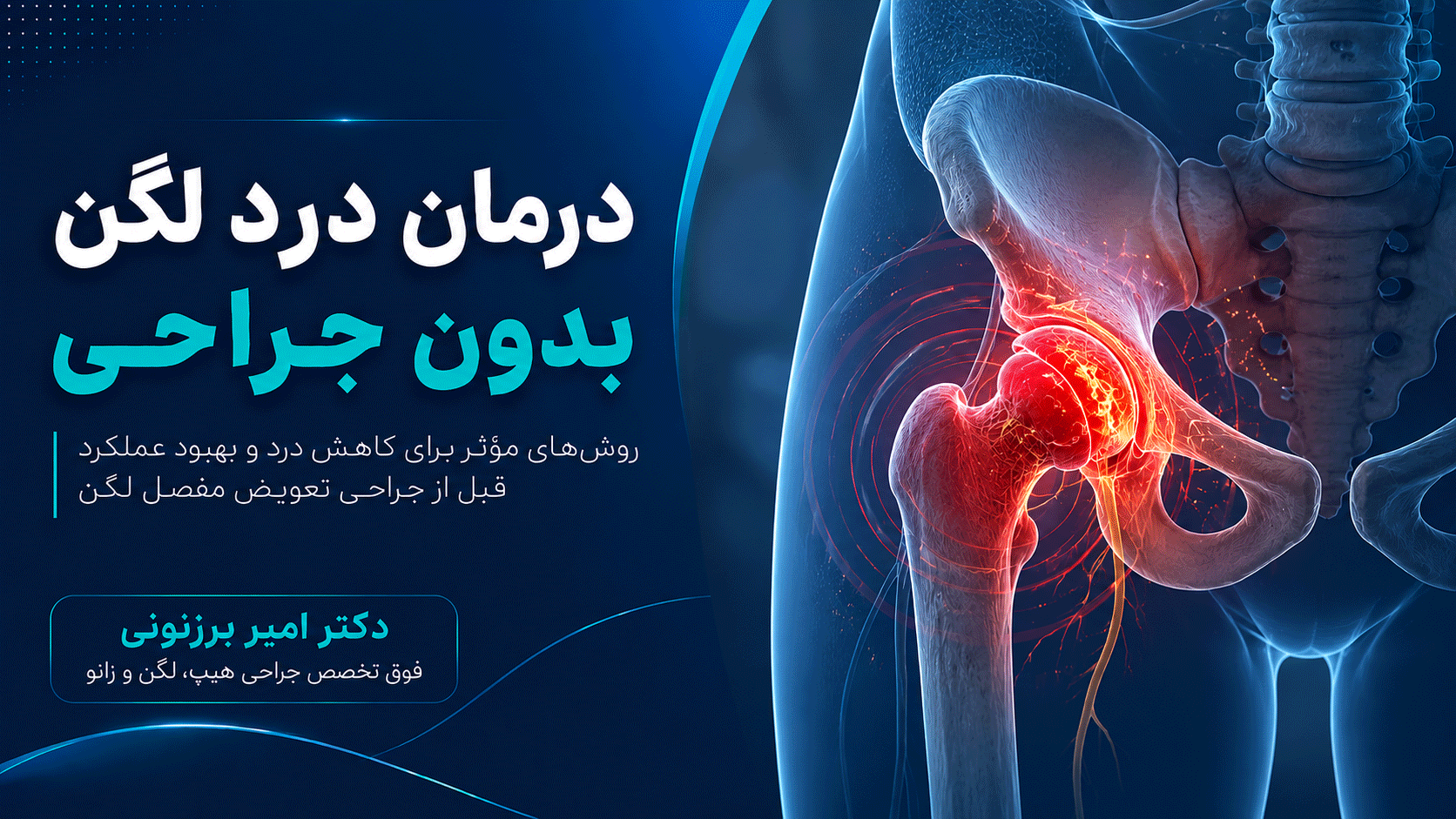 روش‌های غیرجراحی برای درمان درد لگن قبل از تصمیم به جراحی