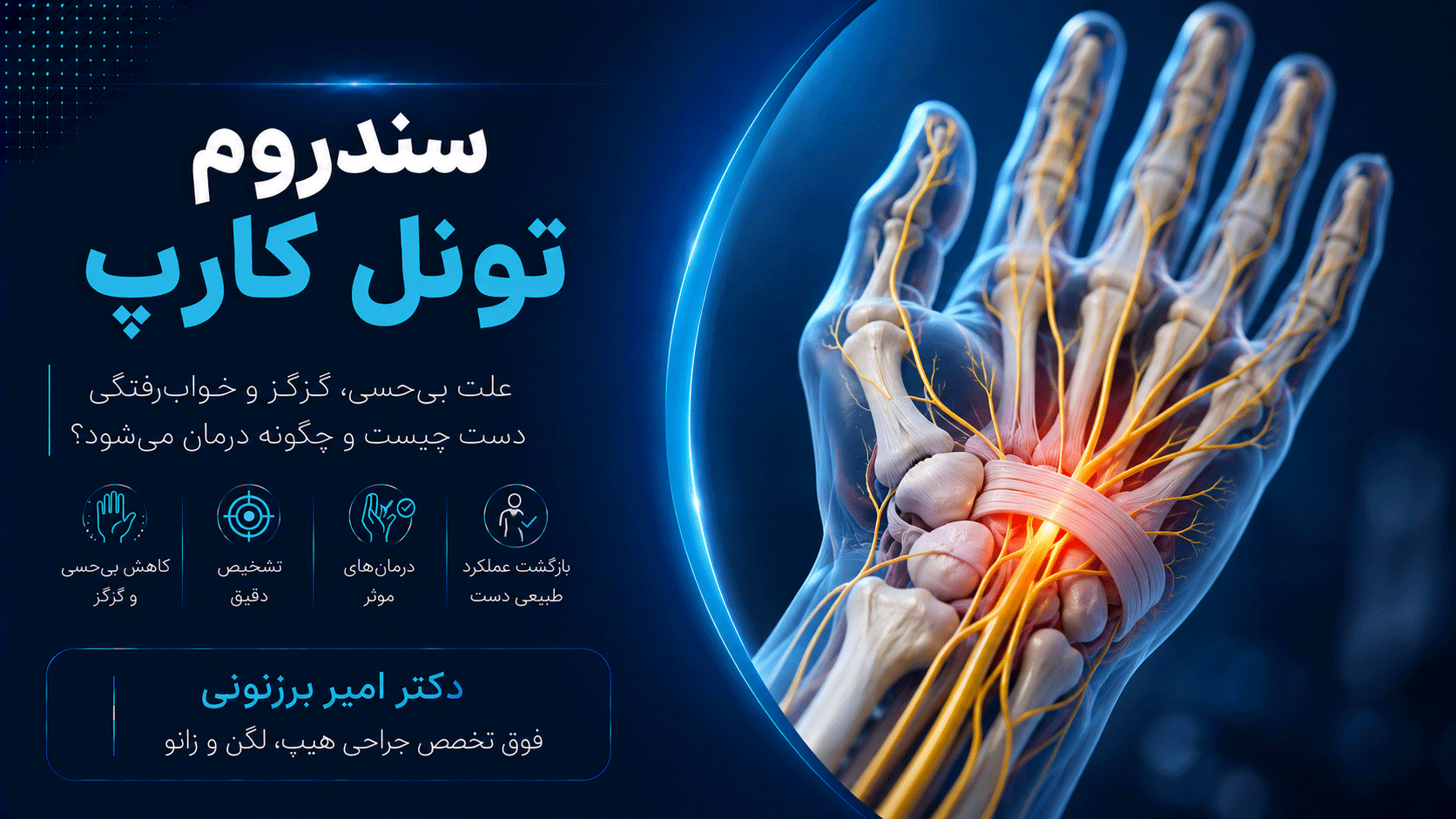 سندروم تونل کارپ : دست هایی که بی حس میشوند