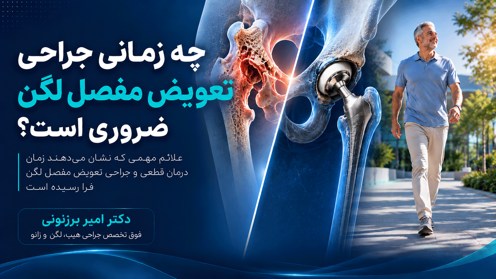 چه زمانی جراحی تعویض مفصل لگن ضروری است؟
