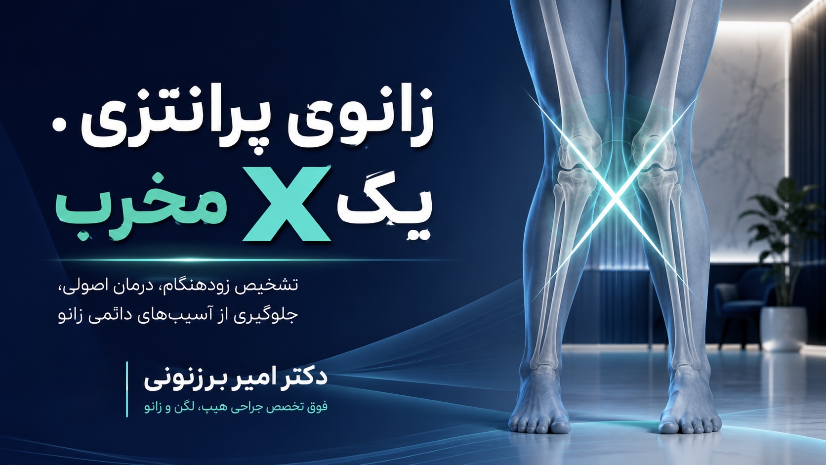 زانوی ضربدری : یک X مخرب