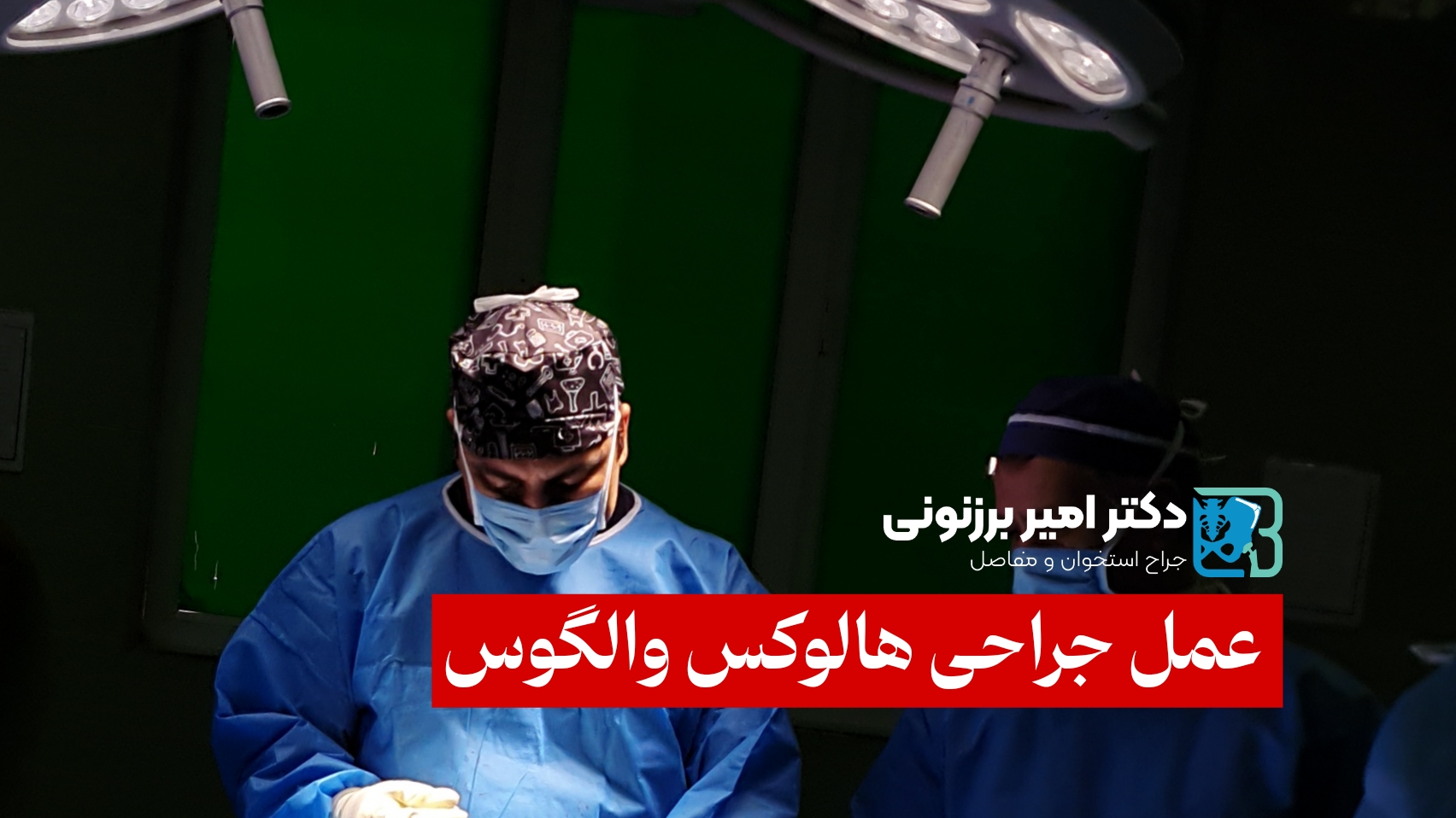 هالوکس والگوس