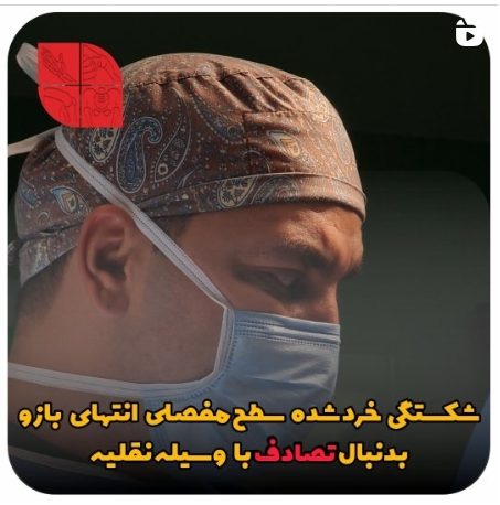 شکستگی خرد شده سطح مفصلی انتهای بازو دنبال تصادف وسیله نقلیه