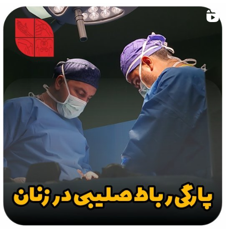 ️پارگی رباط صلیبی در زنان