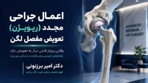 اعمال جراحی مجدد (ریویژن) تعویض مفصل لگن