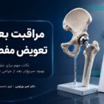 مراقبت‌های بعد از تعویض مفصل لگن برای جلوگیری از عوارض