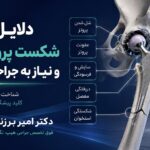 دلایل شایع شکست پروتز لگن و نیاز به جراحی مجدد