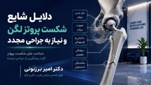دلایل شایع شکست پروتز لگن و نیاز به جراحی مجدد